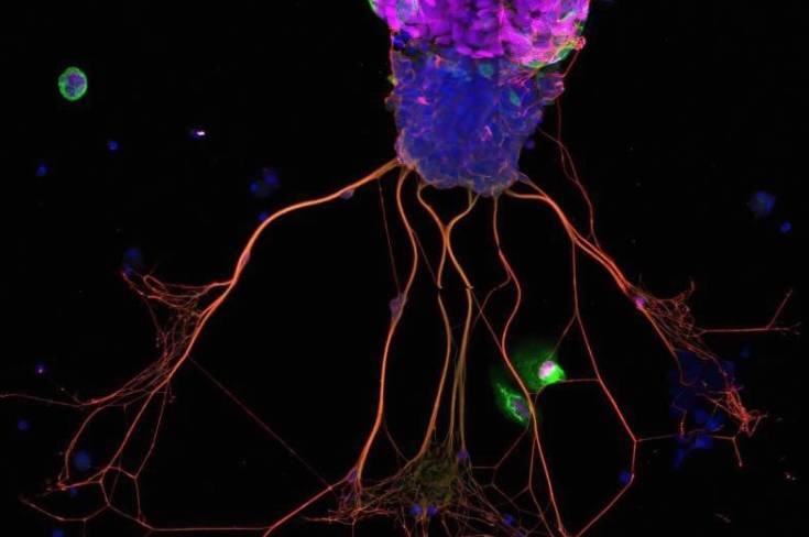 Brian Lin 及其团队培育的类器官的代表性图片。研究人员表示,这是他们首次见到的类器官