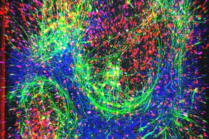 运动神经元(其轴突(神经纤维)以绿色标记)在西达赛奈医疗中心研发的脊髓器官芯片上生长