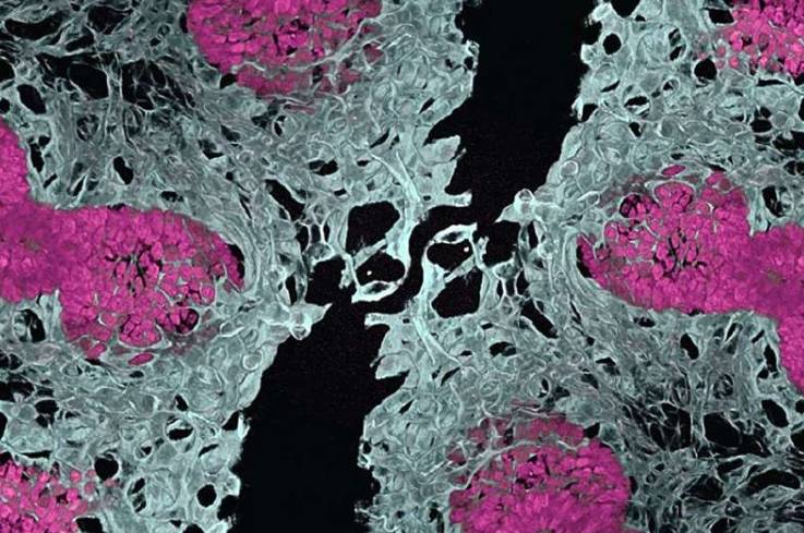 小鼠胚胎肺,显示血管(白色)和肺泡(粉色)。这种使肺类器官血管化的新方法将减少研究中对动物模型的依赖