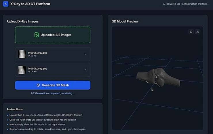 李小萌教授领导的研究团队开发了一种新颖的人工智能算法，只需2到4张X光片快照，即可在一分钟内生成高质量的骨骼和解剖结构3D图像