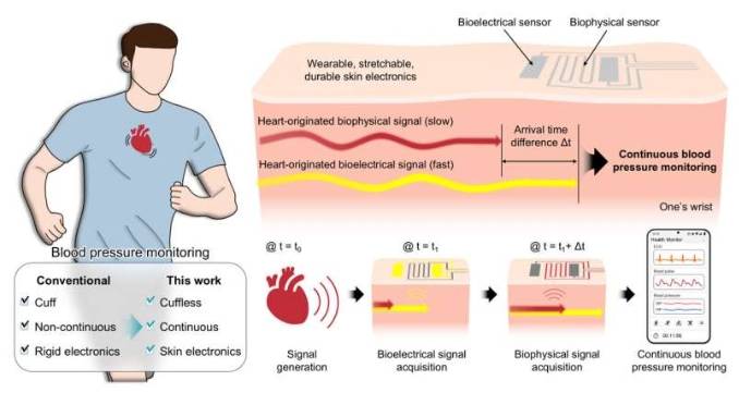 可穿戴实时连续血压监测设备的工作原理及主要特点