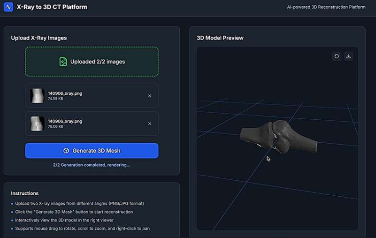 小萌教授领导的研究团队开发了一种新颖的人工智能算法，只需2到4张X光片快照，即可在一分钟内生成高质量的骨骼和解剖结构3D图像