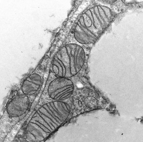 小鼠脂肪组织中的线粒体无法产生SLC35A4-MP,导致线粒体结构受损,功能失调