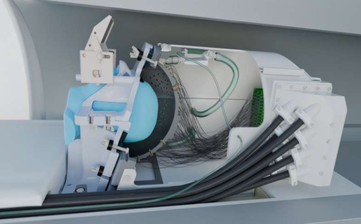 新型超声波设备示意图