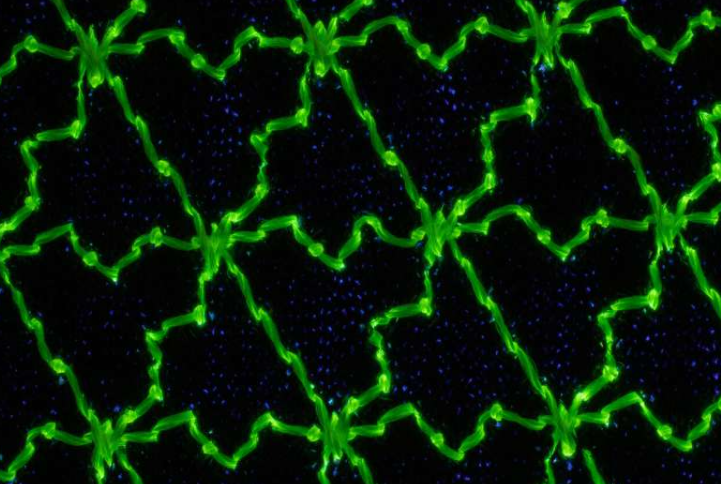 绣花线弹簧马赛克的荧光图像。每条新的线环都以协调的结结构与之前的线环连接,形成一个均匀的三角形图案,牢固地连接在一起,不会散开。