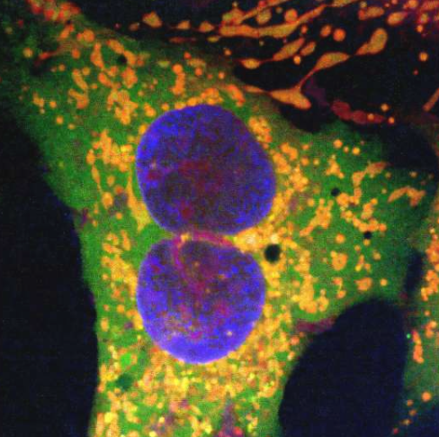 使用基于逆转录子的新基因编辑技术编辑的人类细胞。橙色圆点表示基因编辑成功。绿色圆点表示线粒体表面的荧光蛋白标签。