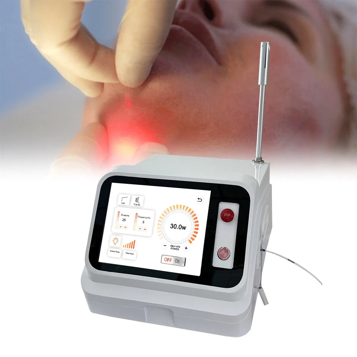 980nm 1470nm Máquina de Lipólisis Láser Liposucción Endoskin No Quirúrgica Endolaser Lifting Facial Lipo Papada Endolift