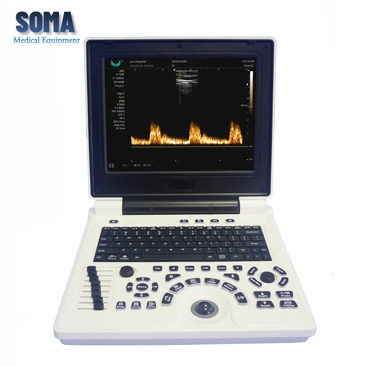 Escáner de ultrasonido portátil avanzado en blanco y negro U10b para clínicas