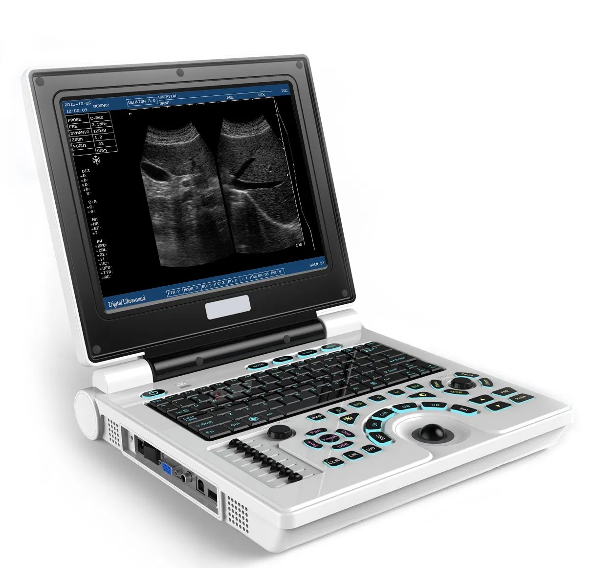 Sistema Avanzado S30b de Ultrasonido Digital B para Imágenes Obstétricas/Ginecológicas y Fetales