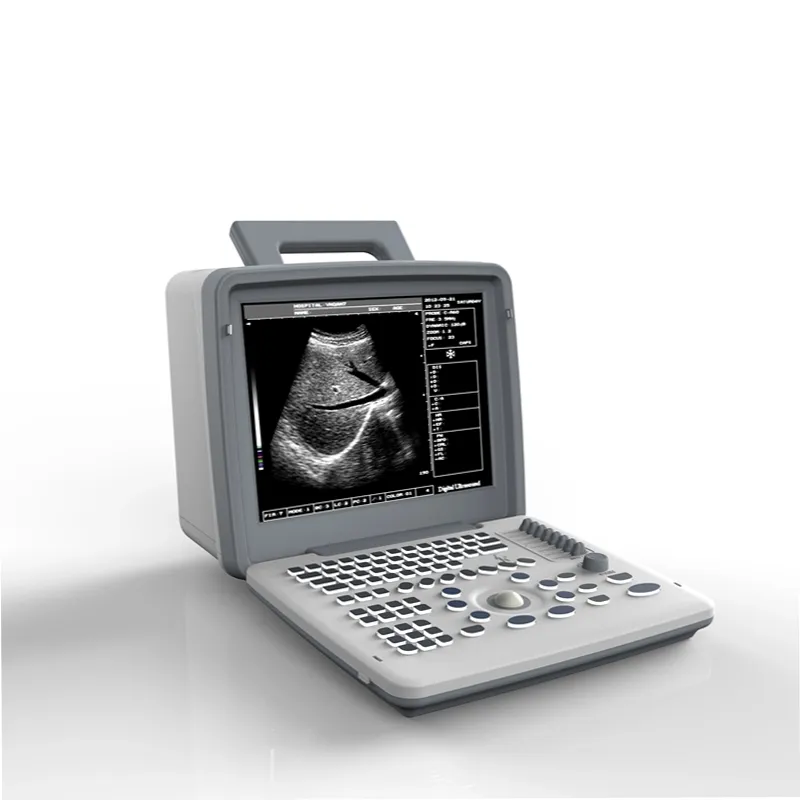 U300 Distribuidor de máquina de escáner ultrasónico médico portátil en blanco y negro para humanos a precio asequible