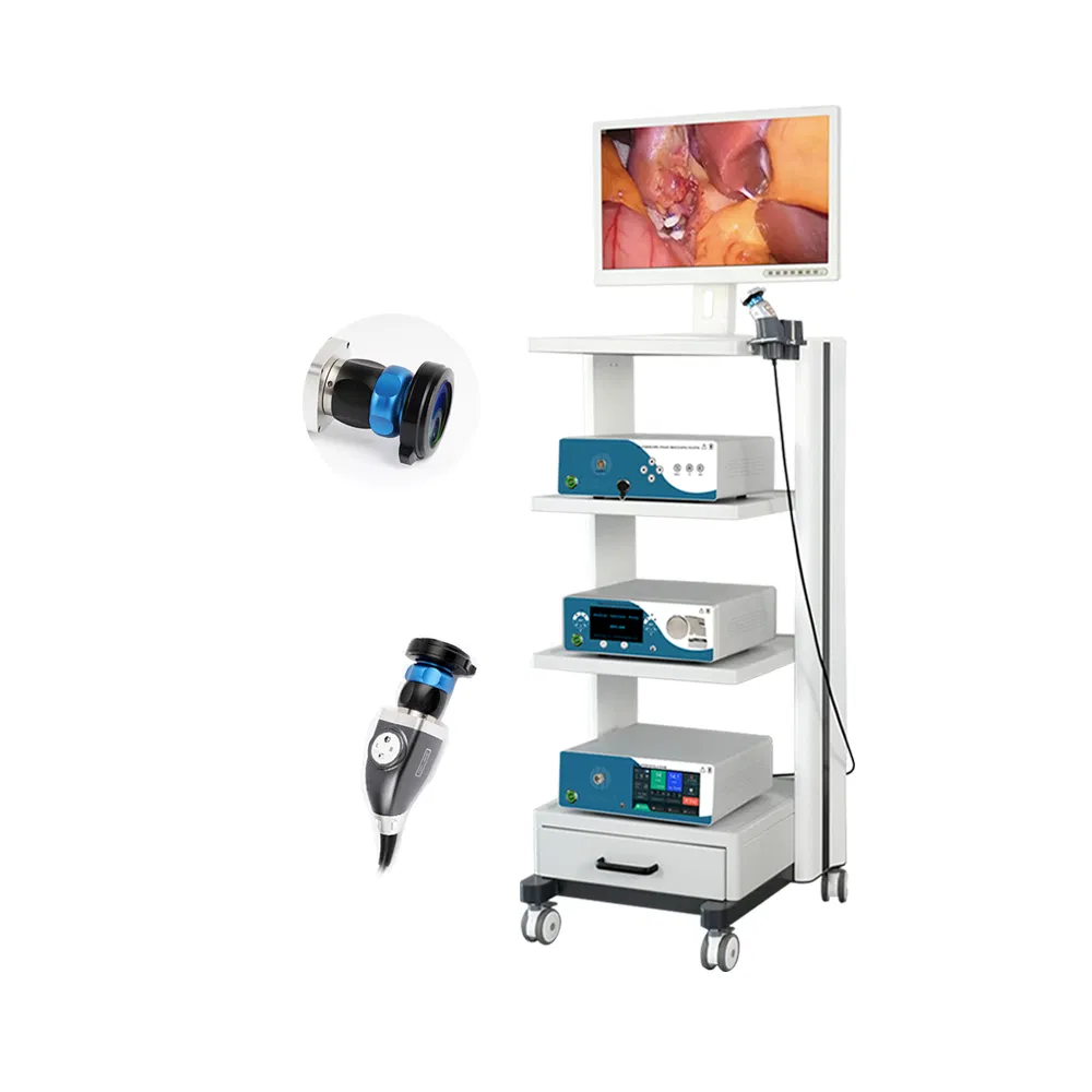 Sistema de cámara endoscópica para cirugía general torre de laparoscopia hospitalaria a precio de fábrica para otorrinolaringología