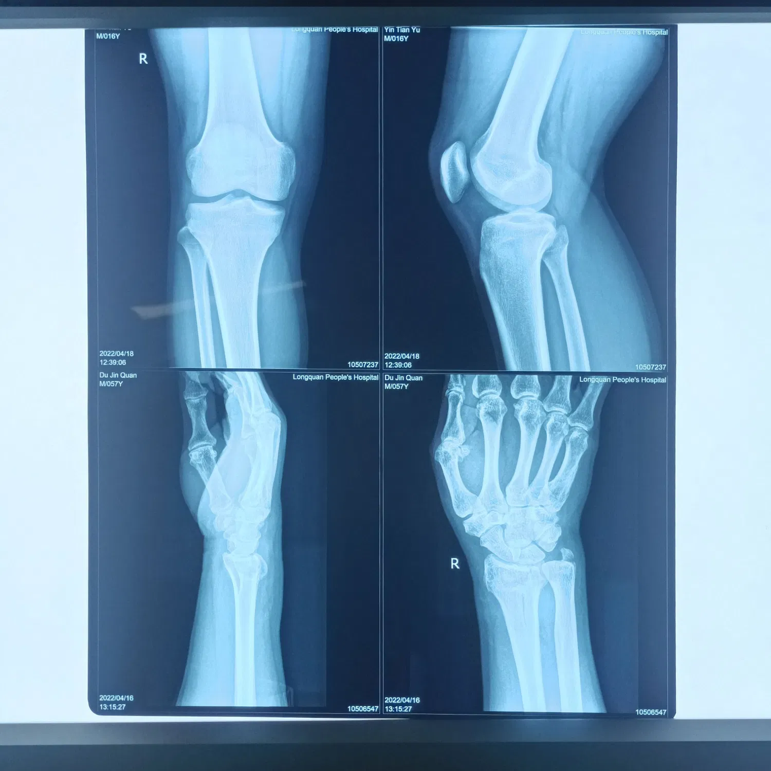 Película láser de plástico seco para mascotas de rayos X médica Nss