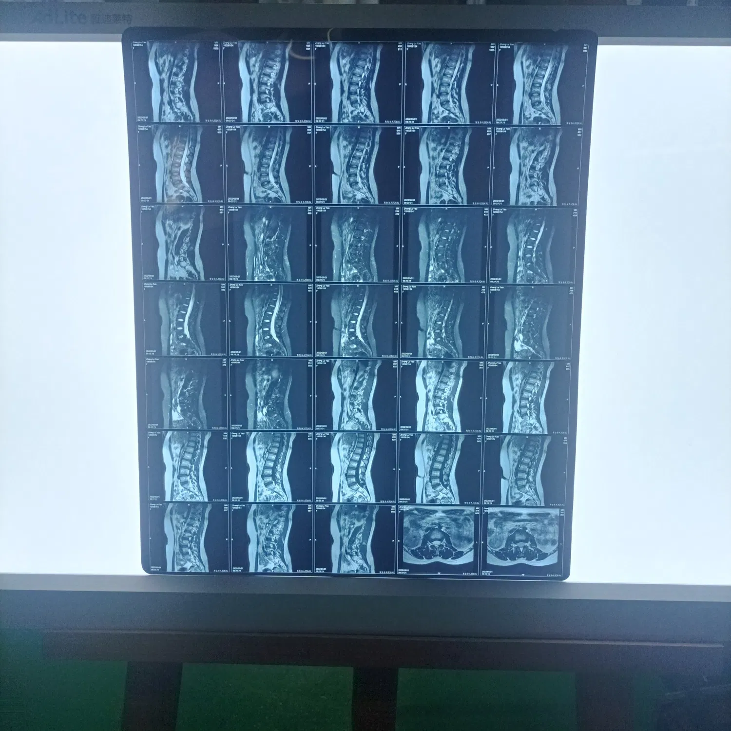 Película láser de plástico seco para mascotas de rayos X