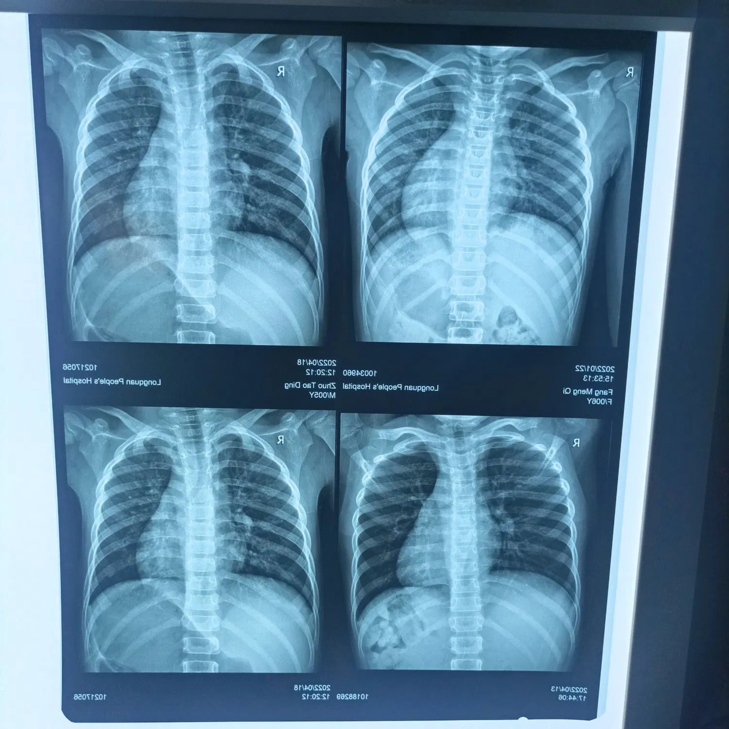 Película térmica de plástico seco para mascotas de rayos X