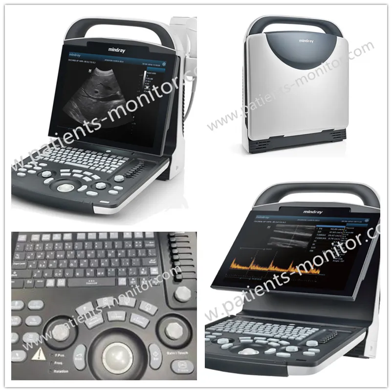 Dp10 Sistema de Imagen Diagnóstica Ultrasonido Digital Usado Equipos Médicos de Ultrasonido