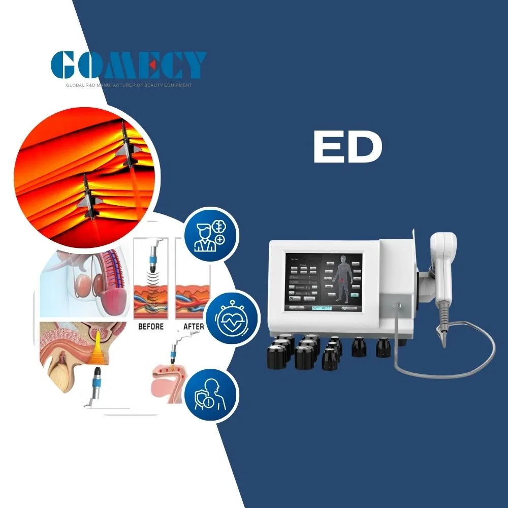 Máquina de terapia de ondas de choque codo de tenista disfunción eréctil dolor muscular fascitis plantar máquinas de terapia física de ondas de choque