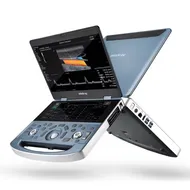 Máquina de ultrasonido Doppler color portátil Mindray Mx7 3D/4D