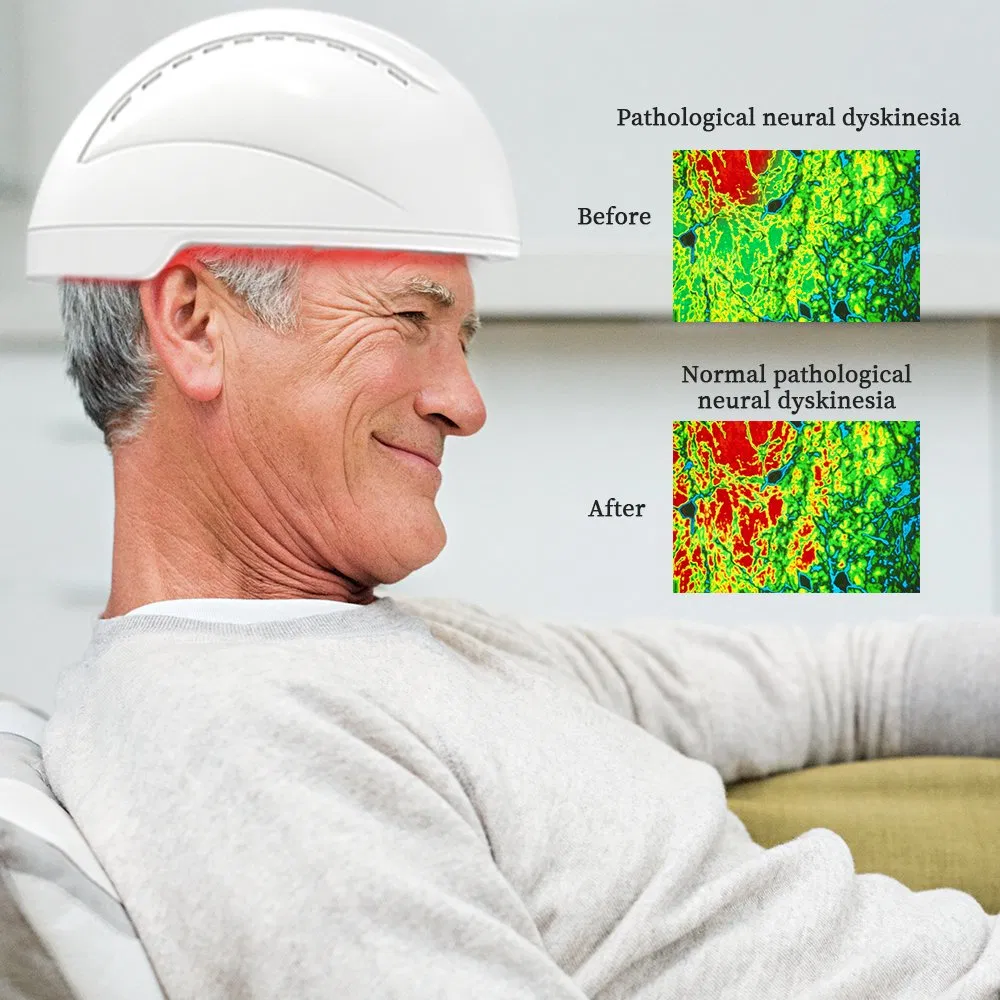 Suyzeko 810nm 256PCS Equipo de Tratamiento Cerebral de Alta Potencia con LED