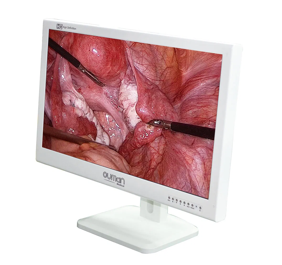 24-Inch Monitor de Endoscopia LCD de Grado Médico