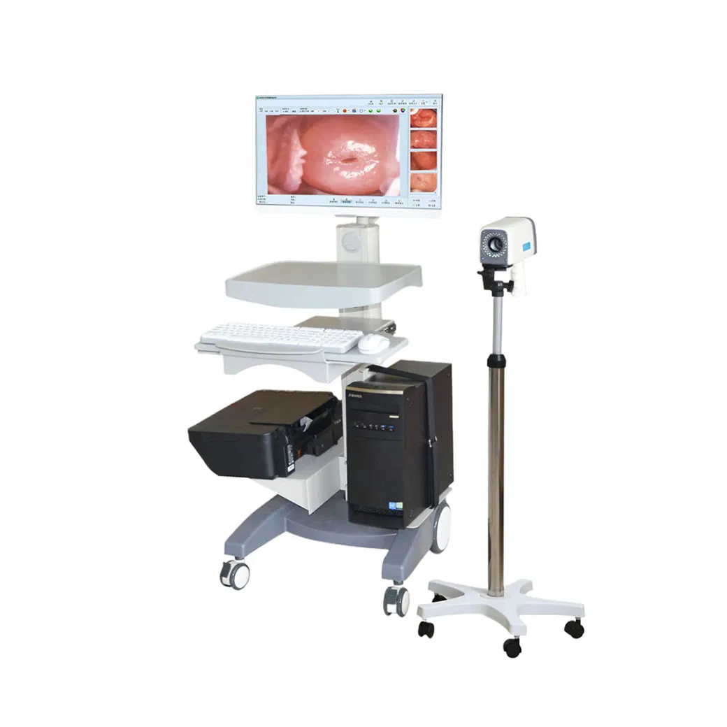 Colposcopio quirúrgico digital ginecológico de alta resolución