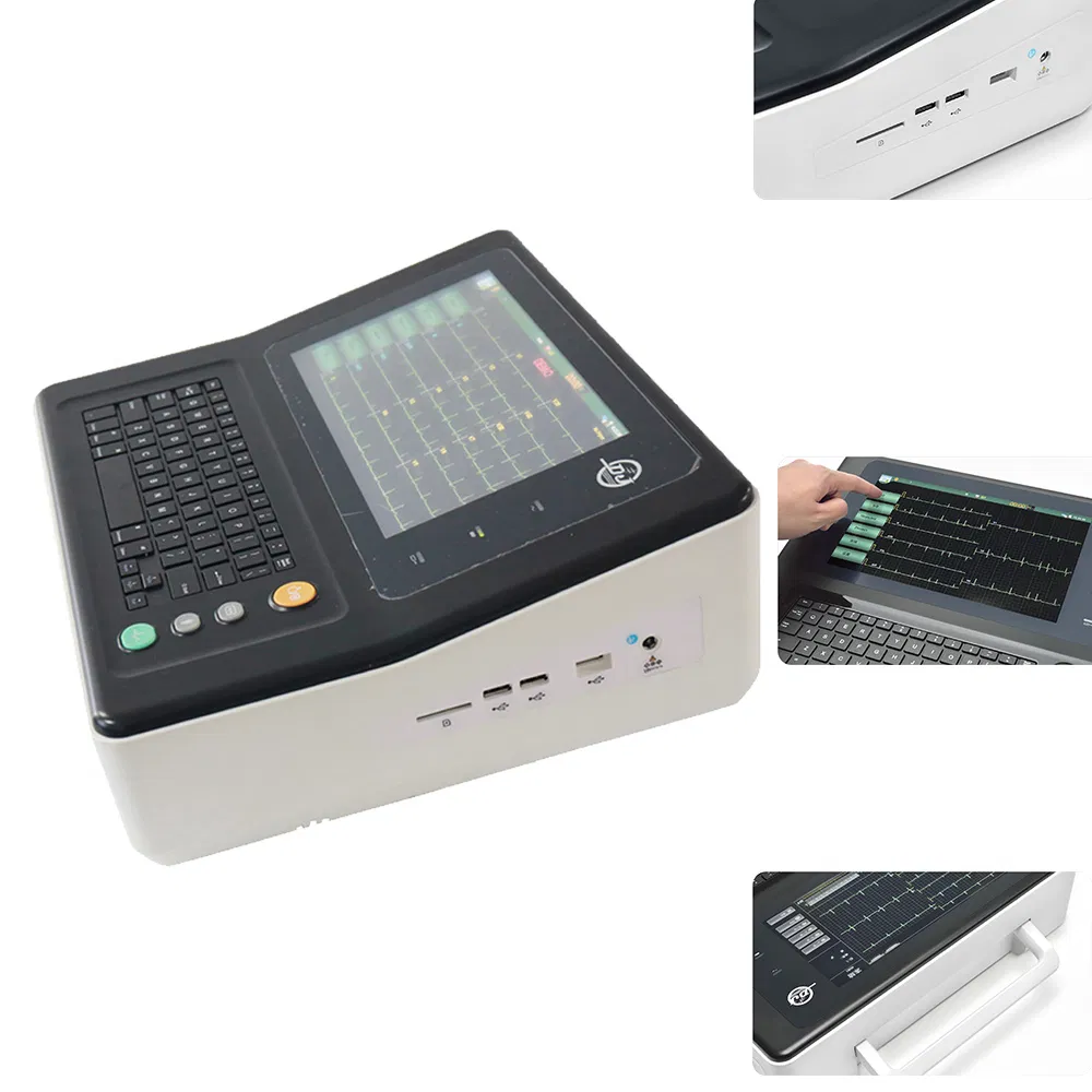 ECG-1801 Portátil 3 Pantalla Táctil de Canal ECG EKG Máquina Digital de Electrocardiograma Precio