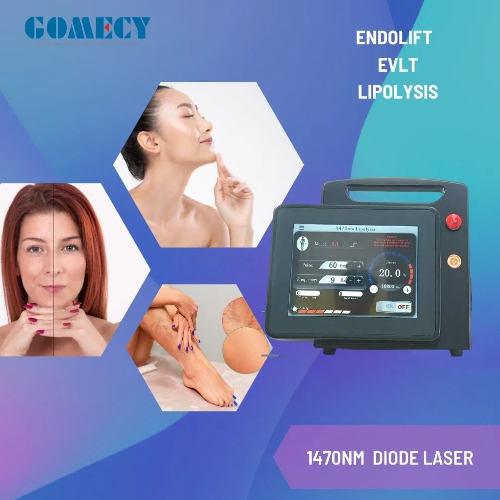 1470nm Dispositivo de láser diodo Endolift para tensado de piel facial y liposucción corporal