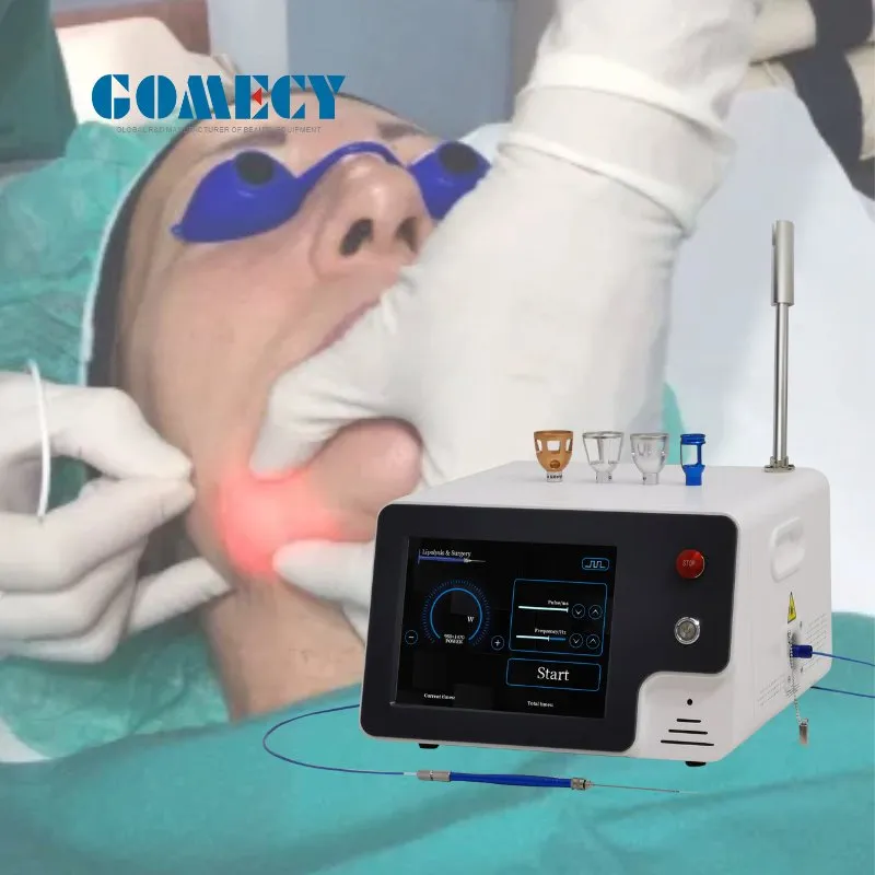 Máquina de Liposucción Láser Gomecy 1470nm Lifting Facial con Láser de Diodo